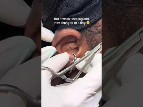 Is your piercing taking too long to heal? I have the solution for you #baselaboratories ✨