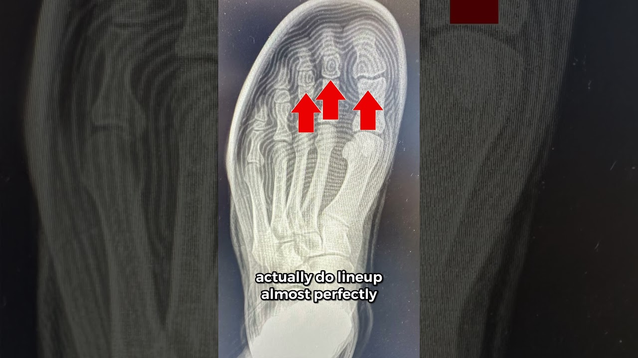 Kobe 9 Elite Protro On X-Ray Is Wild