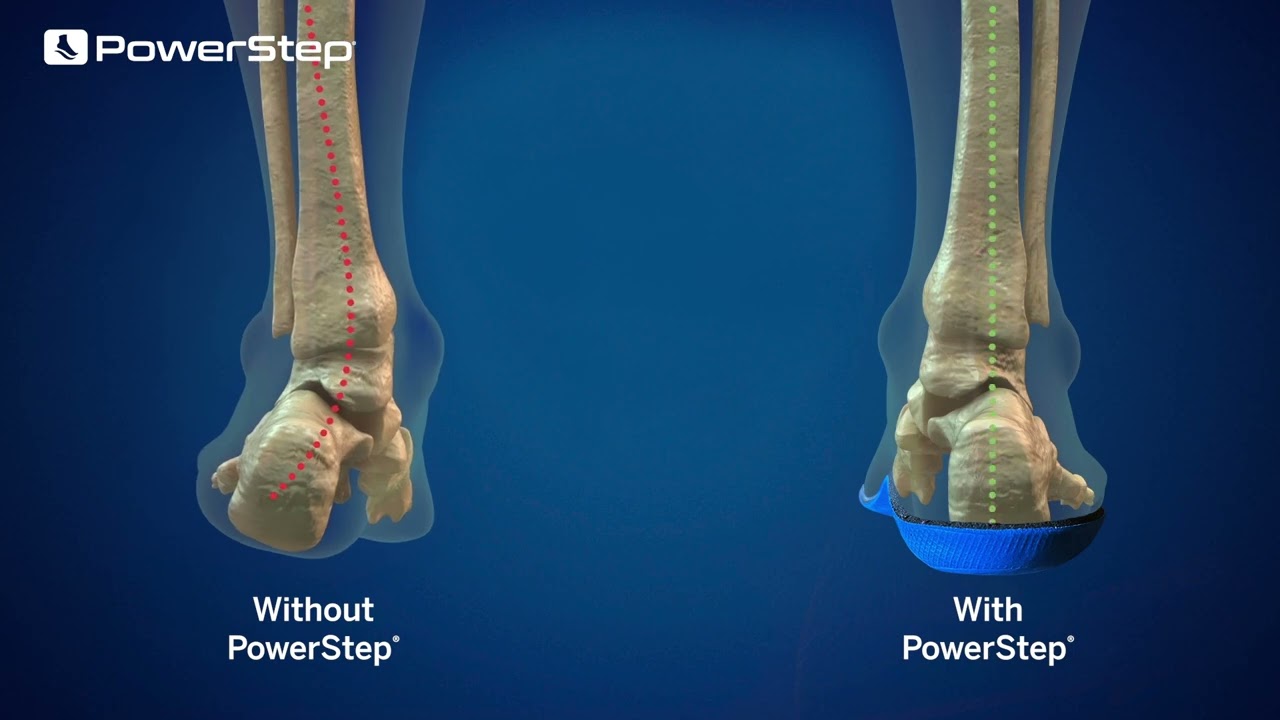 Why PowerStep Pinnacle Insoles are the Best for Foot Pain Relief